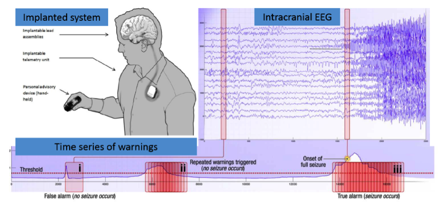 Epilepsy Prediction Using Spark