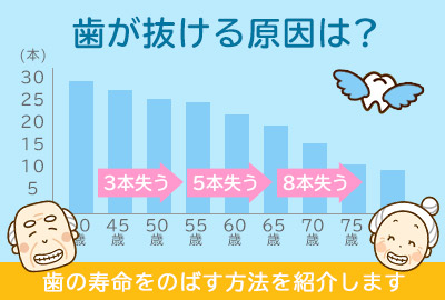 歯の寿命をのばす方法