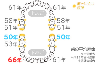 歯の平均寿命と磨きにくい箇所