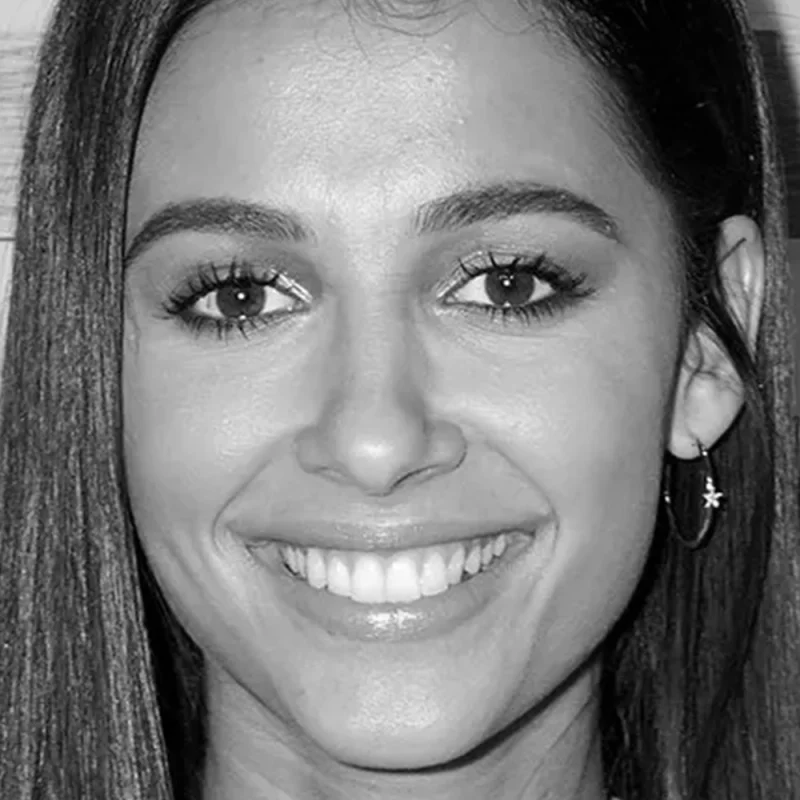 Visual example of Classic cheekbones