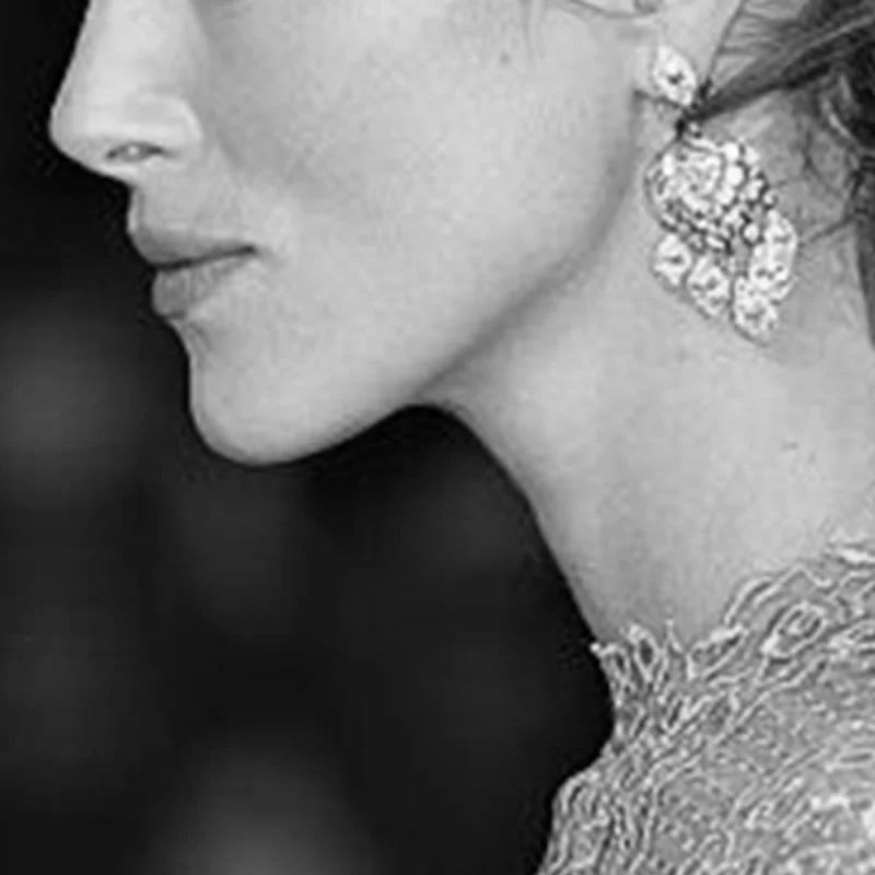 Visual example of Dramatic jawline