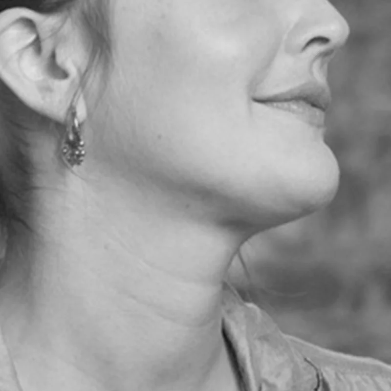 Visual example of Romantic jawline