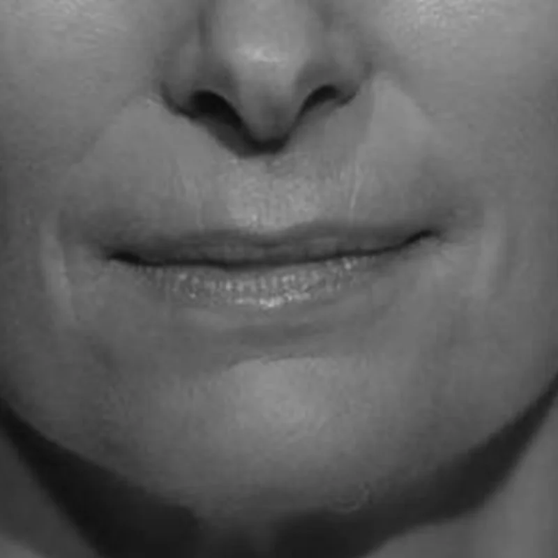 Visual example of Dramatic lips