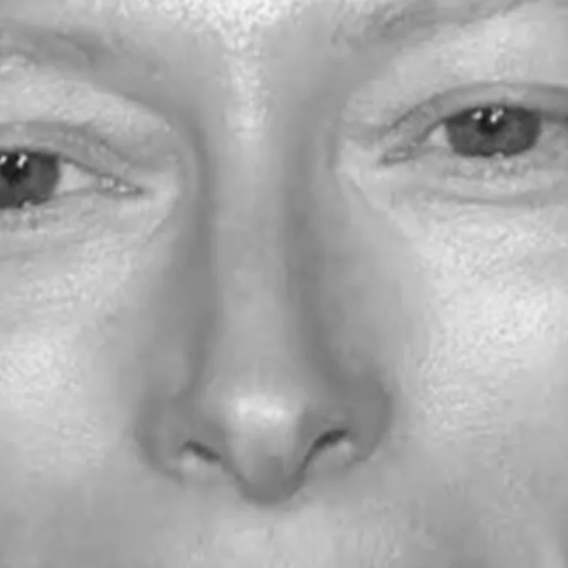 Visual example of Dramatic nose