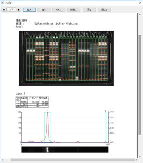 電気泳動解析情報の保存・レポート作成(PDF保存/印刷)
計測結果を画像とともにシートにまとめます。まとめたものはPDFファイルとして保存したり、パソコンに接続しているプリンターで印刷可能です。