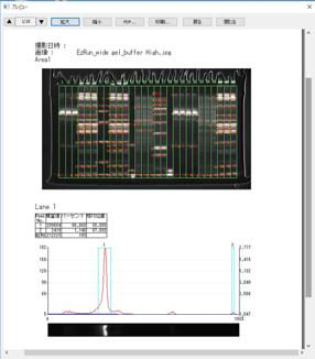 電気泳動解析情報の保存・レポート作成（PDF保存/印刷）
計測結果を画像とともにシートにまとめます。まとめたものはPDFファイルとして保存したり、パソコンに接続しているプリンターで印刷可能です。