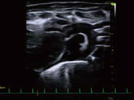 マウス大動脈弓Bモード画像