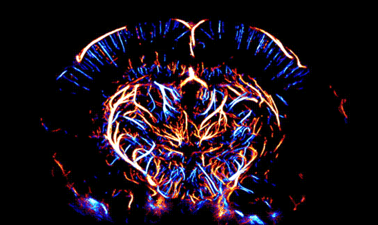 マウス脳の超解像エコー
