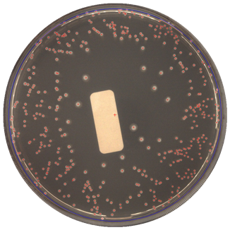 シール等が含まれるプレートのコロニーカウント