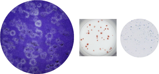 左から、エボラプラークアッセイ (6-well plate)、デングウイルス株4の染色されたプラーク(96-well plate)、インフルエンザウイルス-フォーカスフォーミングアッセイ(FFA)(96-well plate)
