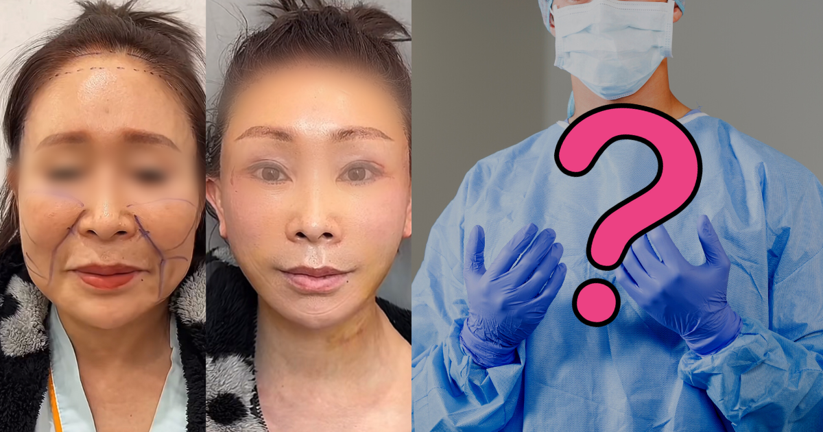 TikTok's Dr. Kim Goes Viral For Botched Plastic Surgery Results,  Unlocking A Twisted Back Story - Koreaboo