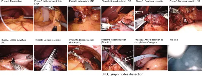 data complexit in surgery