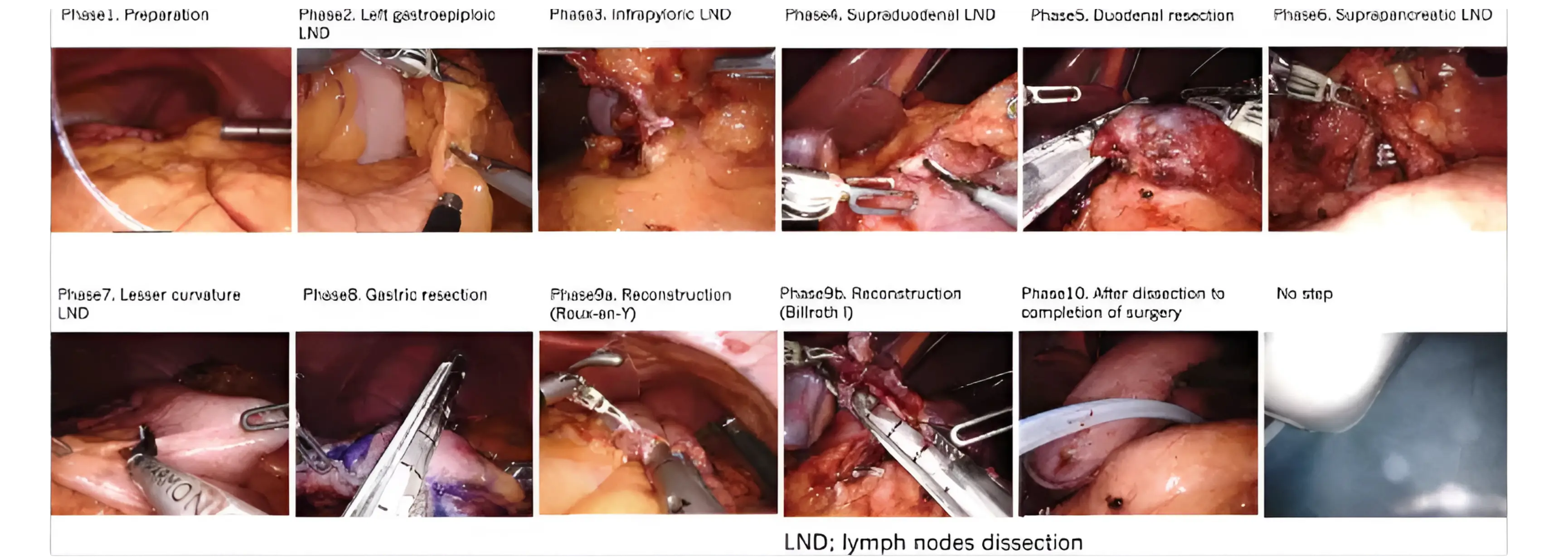 data complexit in surgery