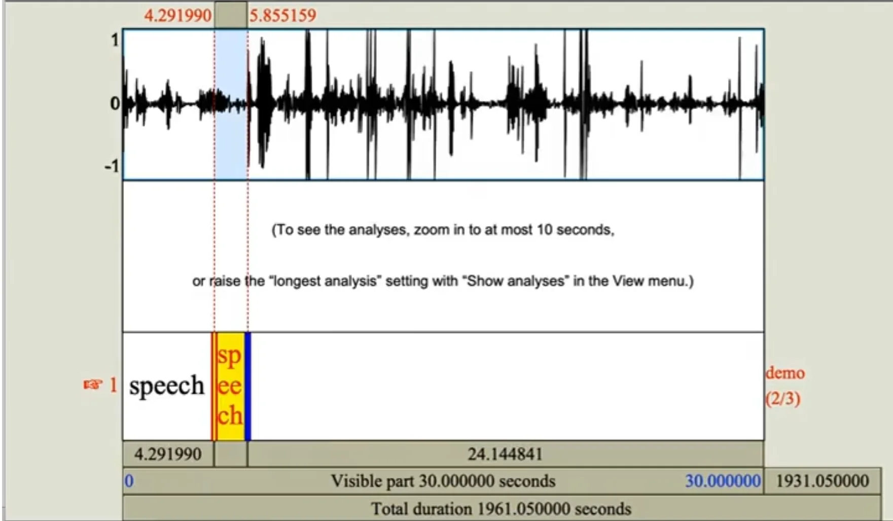 Audio Transcription