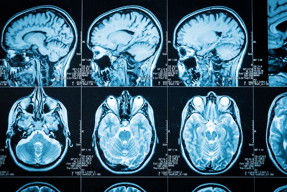 Finding Patterns in Medical Imaging