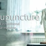 Acupuncture, rooted in traditional Chinese medicine