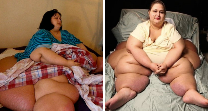 El antes y después de la mujer más gorda del mundo