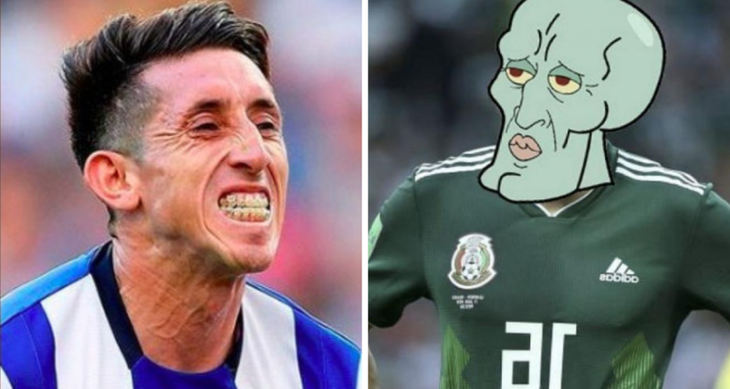 Héctor Herrera posa para revista luego de su operación estética