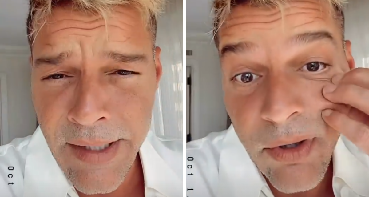 Ricky Martin se aplasta el rostro para demostrar que no hay Botox