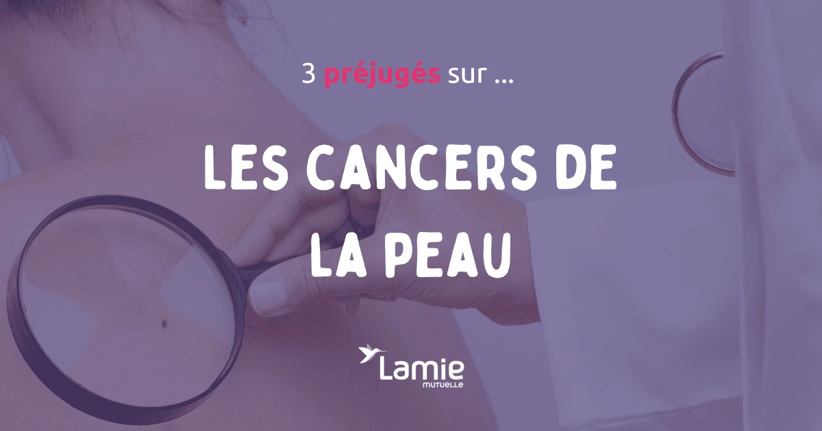 préjugés et idées reçues sur le cancer de la peau