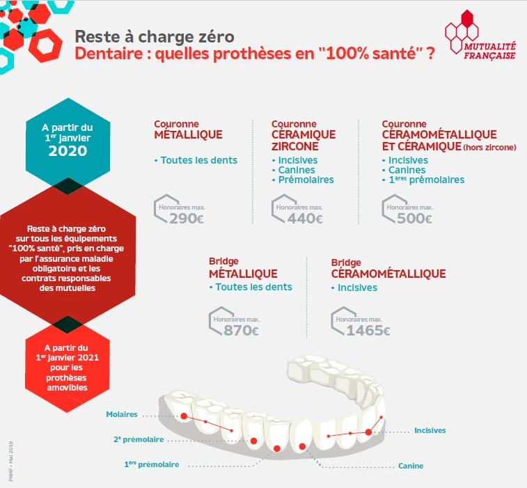 100% Santé Dentaire