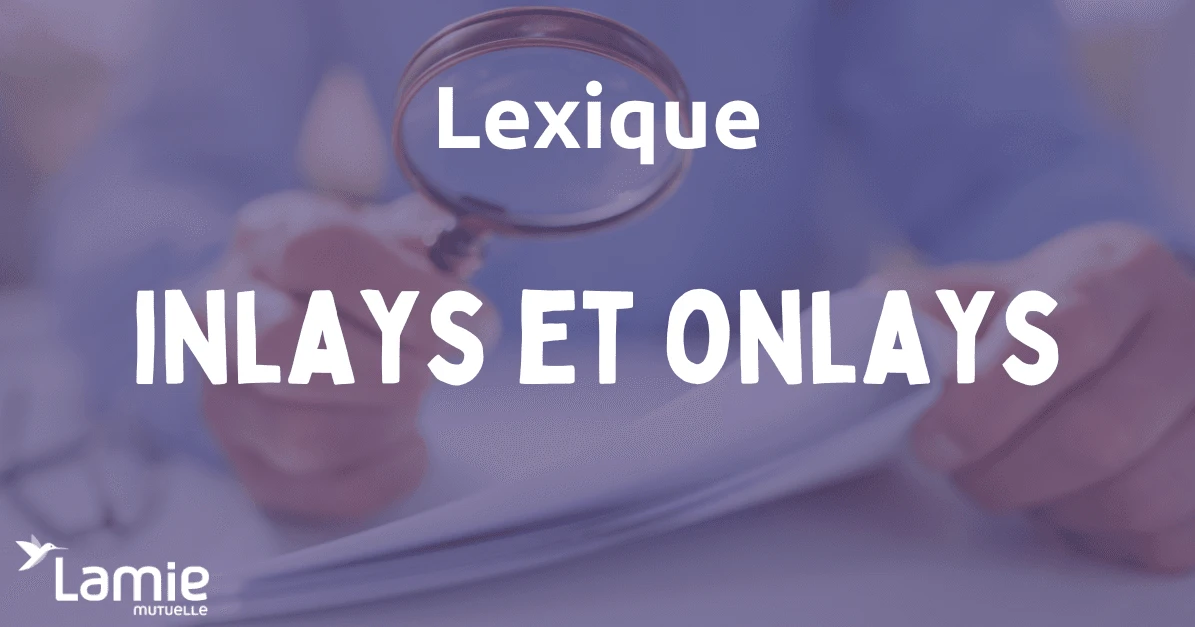 Inlays et onlays définition