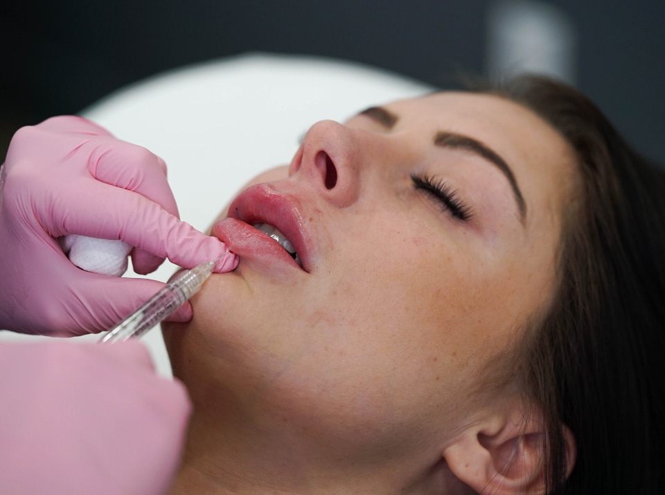 Photo of a woman getting juvederm injections at Laser Away