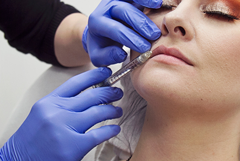 Dermal Fillers