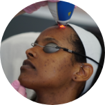 LaserAway service image for Laser Facials