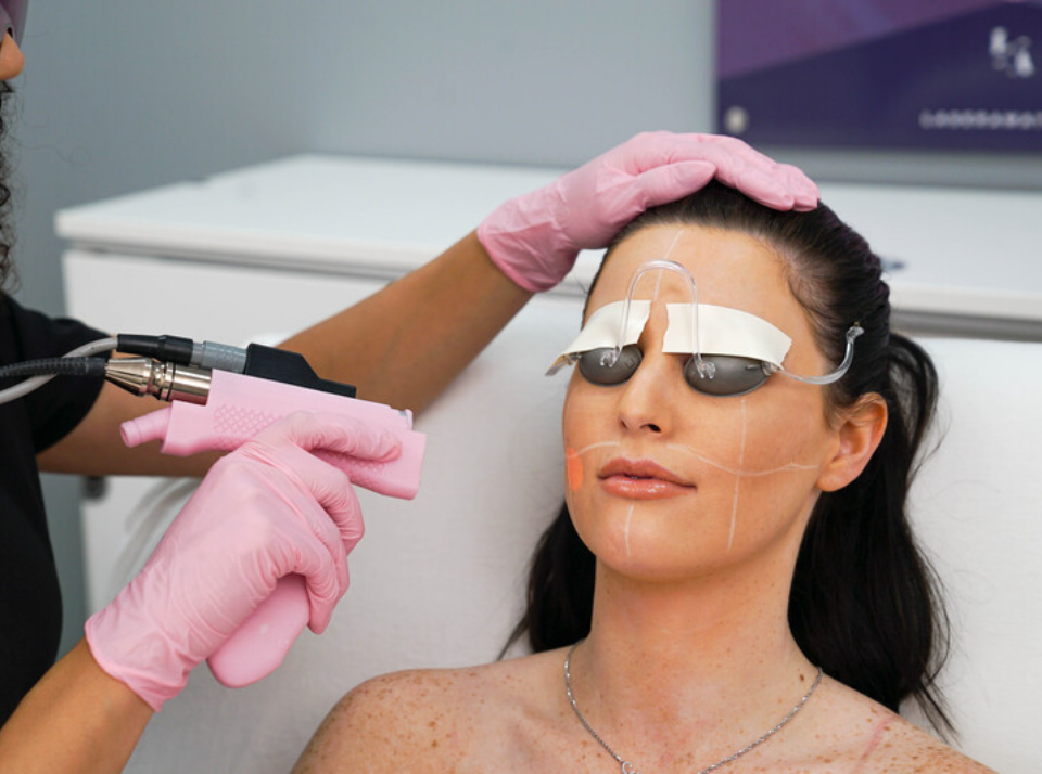 Instant Glow Laser Facial