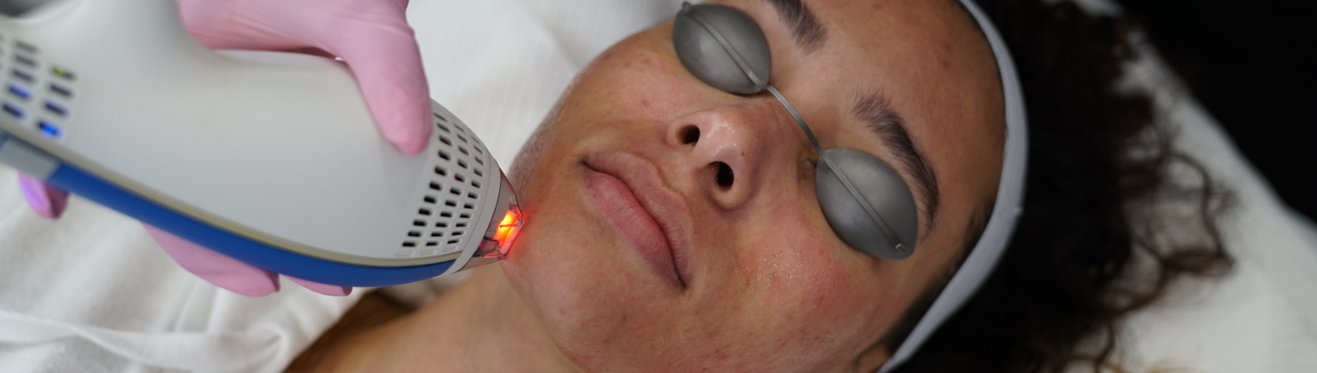 Image for Acne Scar Removal