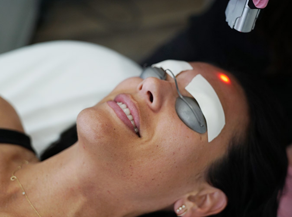 FIRE + ICE INSTANT LASER FACIAL