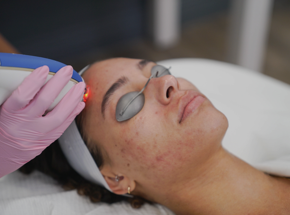 Clear + Brilliant® Laser Facial