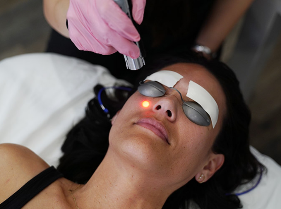 Instant Glow Laser Facial