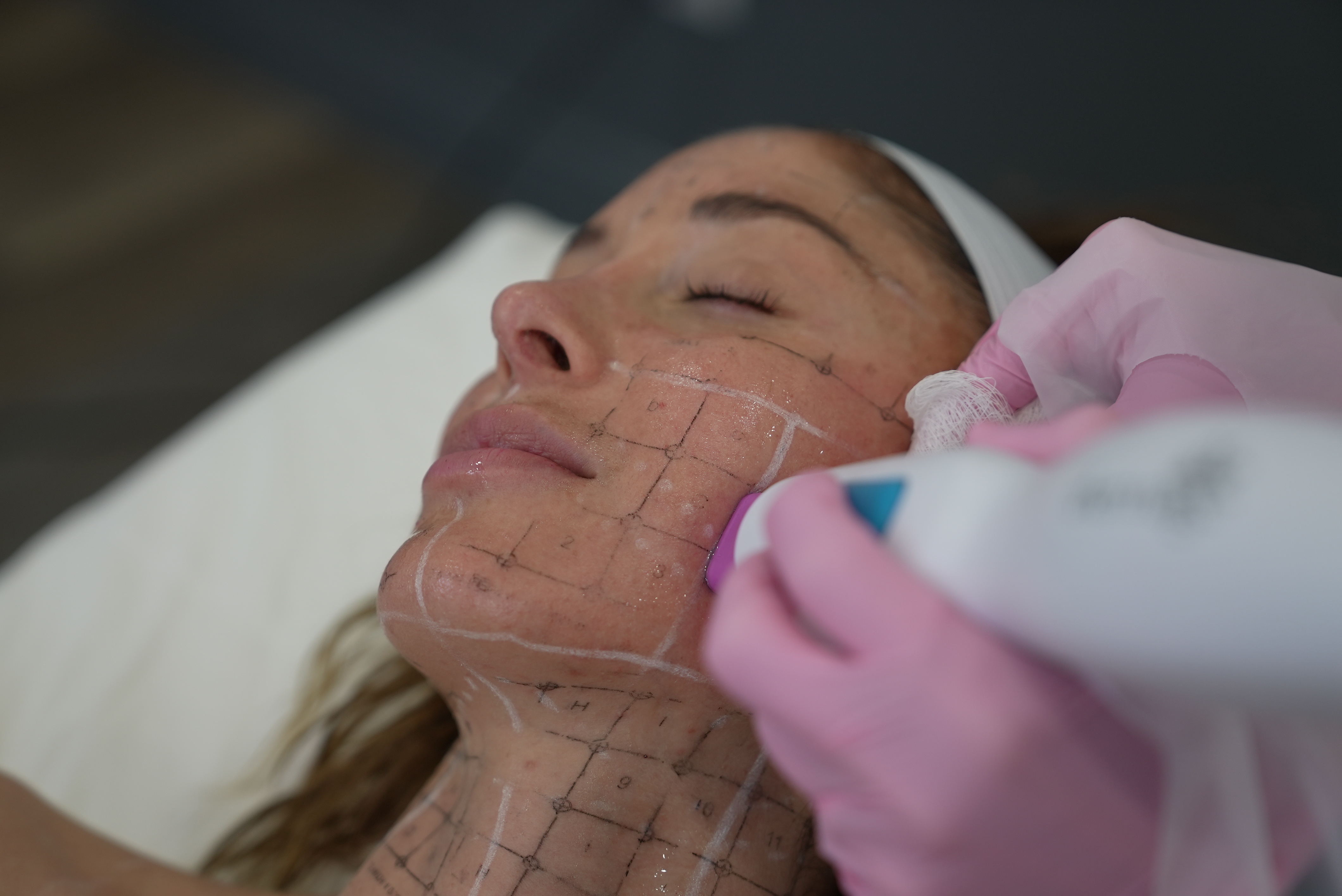 Which Body Contouring Treatment Should I Choose?: Los Gatos Dermatology:  Cosmetic Dermatologists