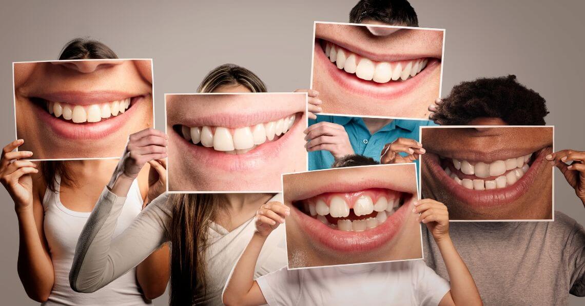 Young people holding laughing mouth pictures in front of their faces.