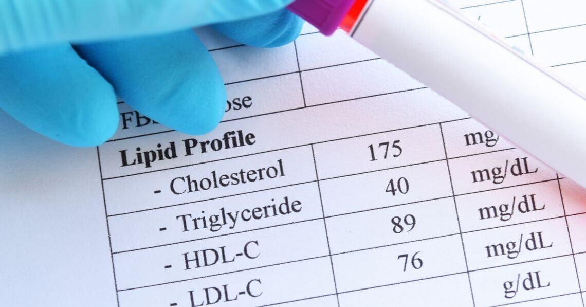 A lipid chart