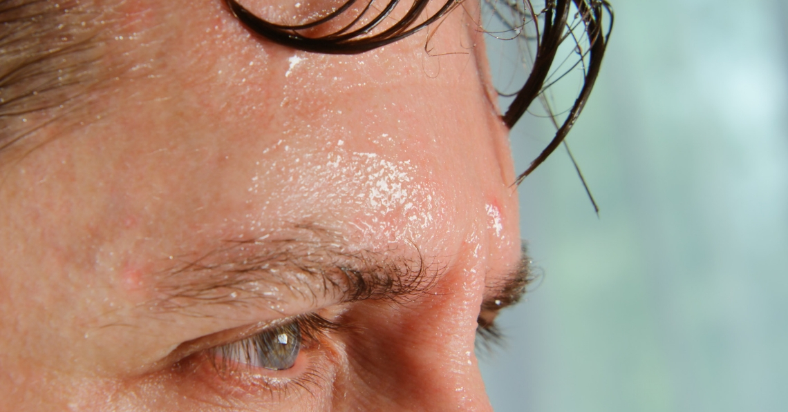 Close up of sweaty forehead of a man