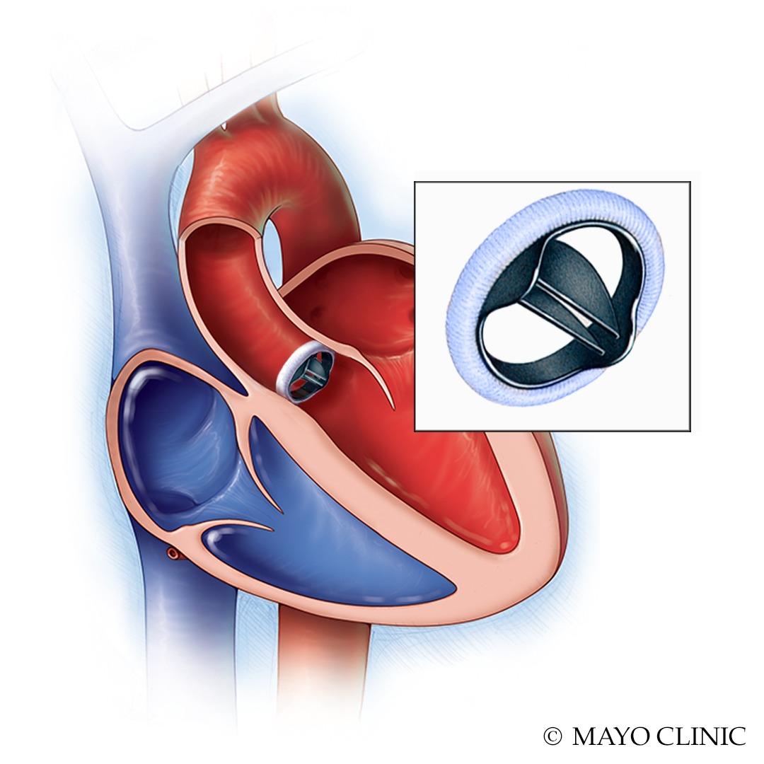 Mayo Clinic