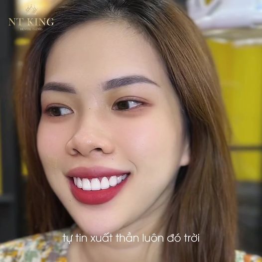 NT KING Dentist - Chuyên Điều Trị Cười Hở Lợi Giảm Hô