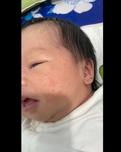 Kutieskin - Chăm sóc làn da cho con cưng