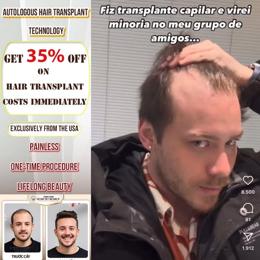 Phòng Khám Cấy Tóc Y Học Quốc Tế - Hair Transplant Clinic