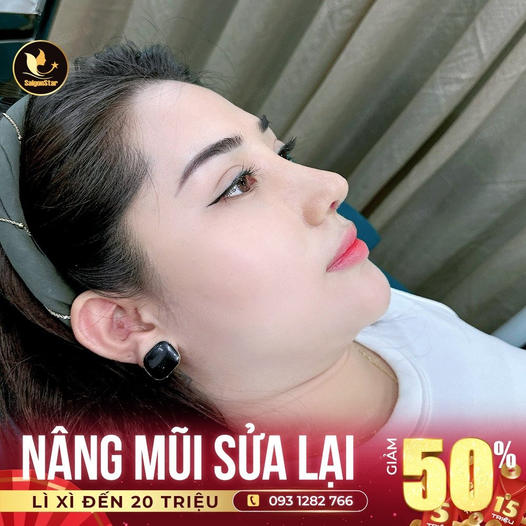 Bác sĩ Hoạt - Viện Thẩm Mỹ Quốc Tế