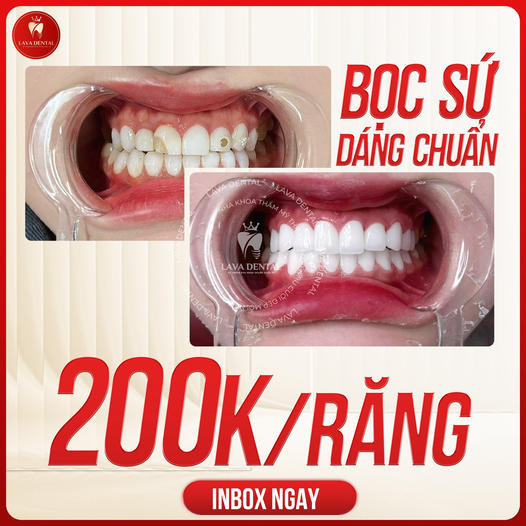 Lava Dental - Viện Răng Hàm Mặt Quốc Tế
