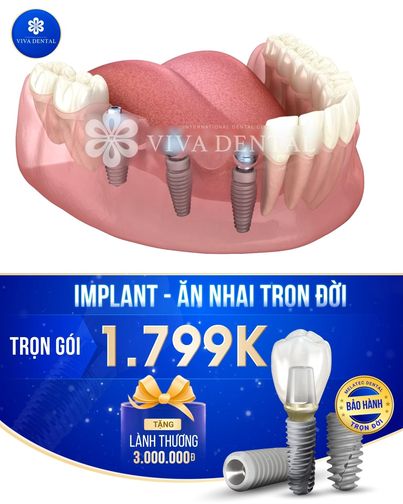 Nha Khoa Quốc Tế Viva Dental