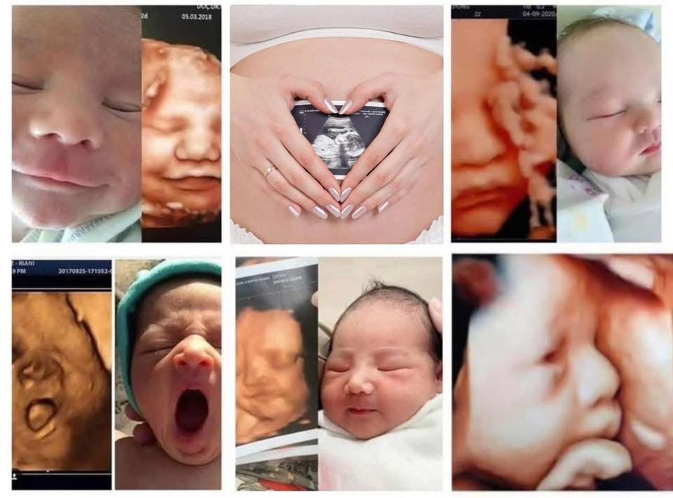 Hội Bà Bầu Và Làm Mẹ