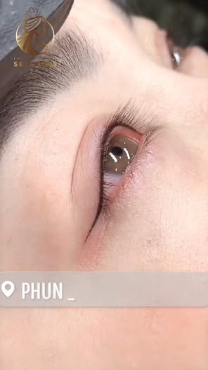 Thẩm Mỹ Viện Quốc Tế Sen Aura