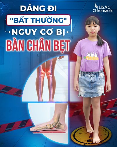 USAC Chiropractic - Điều trị bàn chân bẹt chuẩn Mỹ