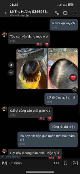 Thik&Fix Tóc hết rụng, mọc trở lại - Chi nhánh 17