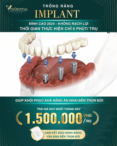 Ts Bs Hải Vân - Nha Khoa Vindental Sài Gòn